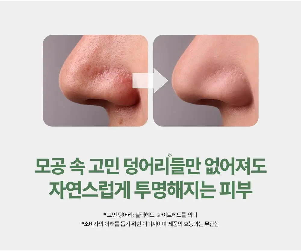 [NEW] 에센허브 티트리 안티세범 딥 클렌징오일 300ml 상세페이지 14